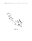 EXPANDABLE INTERBODY FUSION DEVICE diagram and image