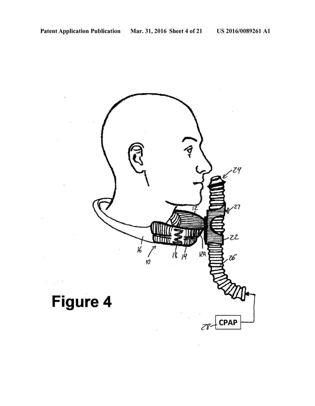 Respiratory Treatment Devices for Airway Obstruction Therapy and the Like - diagram, schematic, and image 05