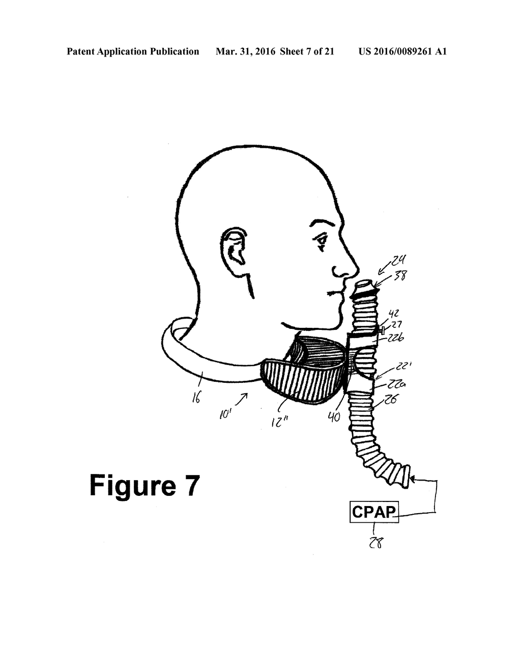 Respiratory Treatment Devices for Airway Obstruction Therapy and the Like - diagram, schematic, and image 08