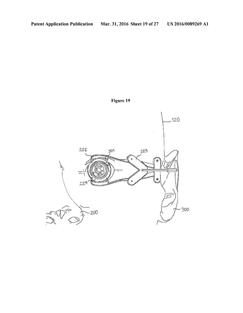 LASER SYSTEM FOR EYE SURGERY - diagram, schematic, and image 20