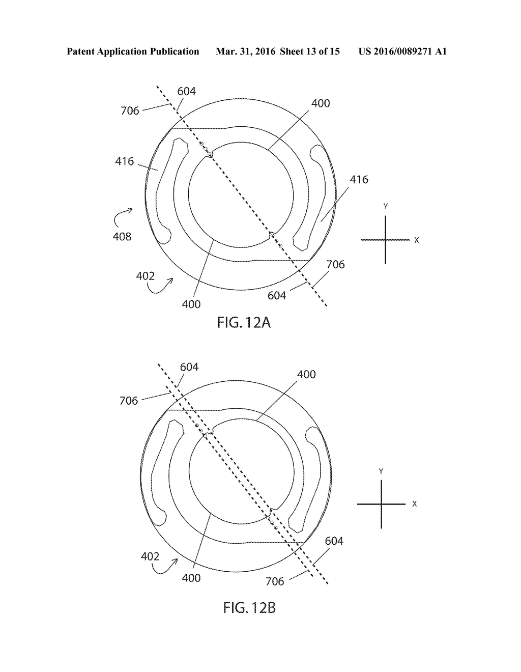 Method for Alignment of Intraocular Lens - diagram, schematic, and image 14