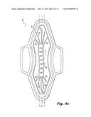 ABSORBENT ARTICLE DEMONSTRATING CONTROLLED DEFORMATION AND LONGITUDINAL     FLUID DISTRIBUTION diagram and image