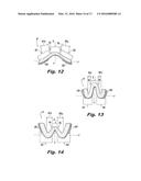 ABSORBENT ARTICLE DEMONSTRATING CONTROLLED DEFORMATION AND LONGITUDINAL     FLUID DISTRIBUTION diagram and image