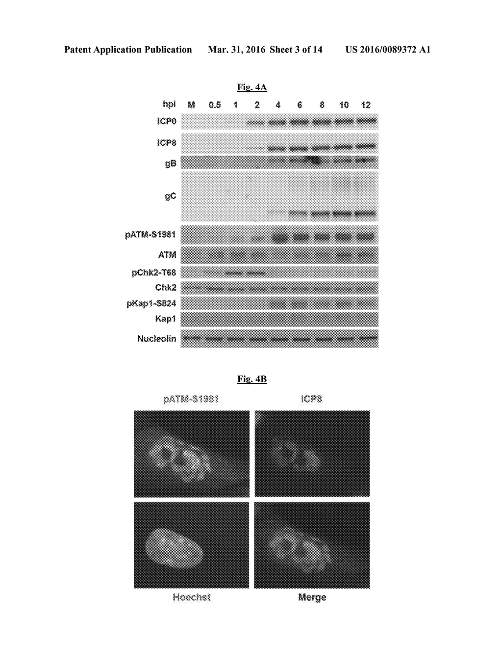 Compositions Useful for Treating Herpes Simplex Labialis and/or Herpes     Esophagitis, and Methods Using Same - diagram, schematic, and image 04