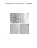 POLYMER-TISSUE HYBRID BIOMATERIALS AND METHODS OF MAKING AND USING SAME diagram and image