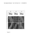 POLYMER-TISSUE HYBRID BIOMATERIALS AND METHODS OF MAKING AND USING SAME diagram and image