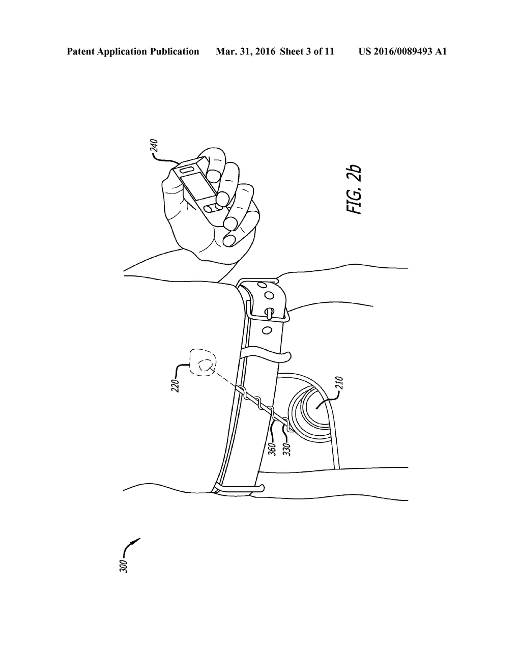 MEDICAL DEVICE ANTENNA SYSTEMS HAVING EXTERNAL ANTENNA CONFIGURATIONS - diagram, schematic, and image 04