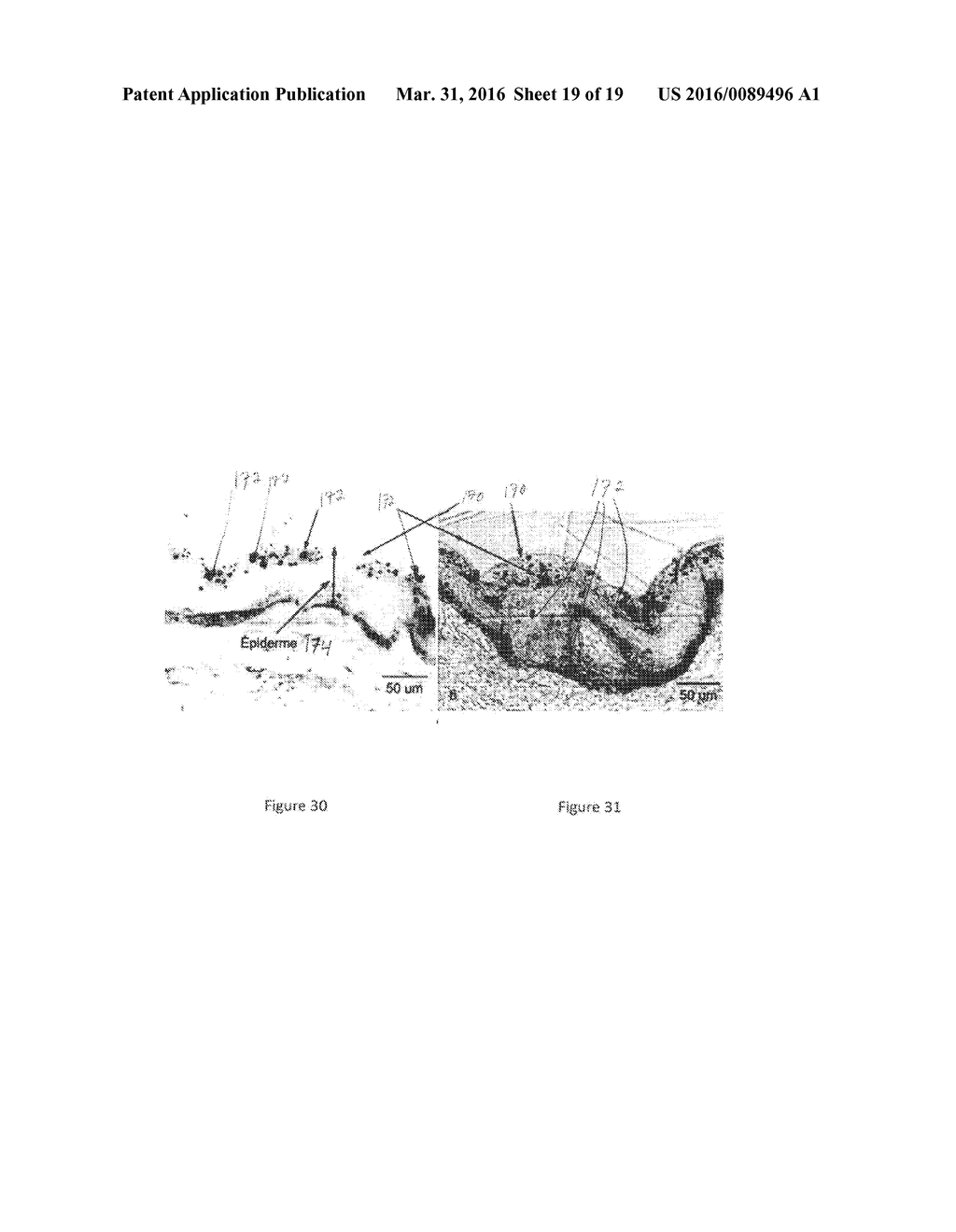 NEEDLELESS SYRINGE AND METHOD FOR DELIVERING THERAPEUTIC PARTICLES - diagram, schematic, and image 20