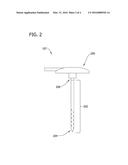 METHOD OF USING A CATHETER ASSEMBLY diagram and image