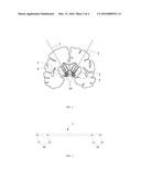 LEAD, DEVICE AND METHOD FOR ELECTRICAL STIMULATION OF DEEP BRAIN diagram and image