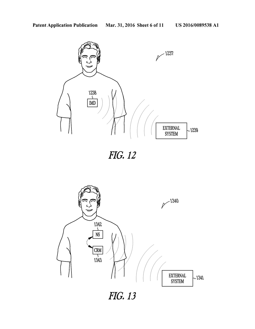 SYSTEMS AND METHODS FOR AVOIDING NEURAL STIMULATION HABITUATION - diagram, schematic, and image 07