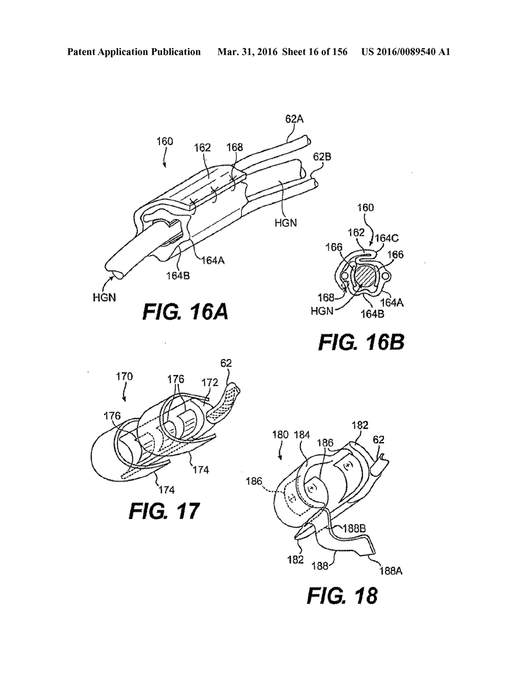 OBSTRUCTIVE SLEEP APNEA TREATMENT DEVICES, SYSTEMS AND METHODS - diagram, schematic, and image 17