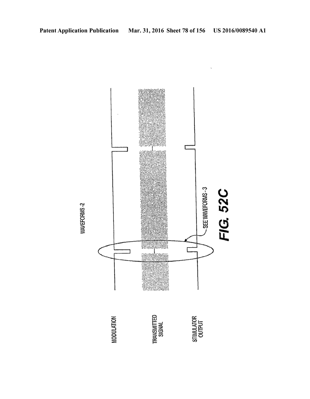 OBSTRUCTIVE SLEEP APNEA TREATMENT DEVICES, SYSTEMS AND METHODS - diagram, schematic, and image 79