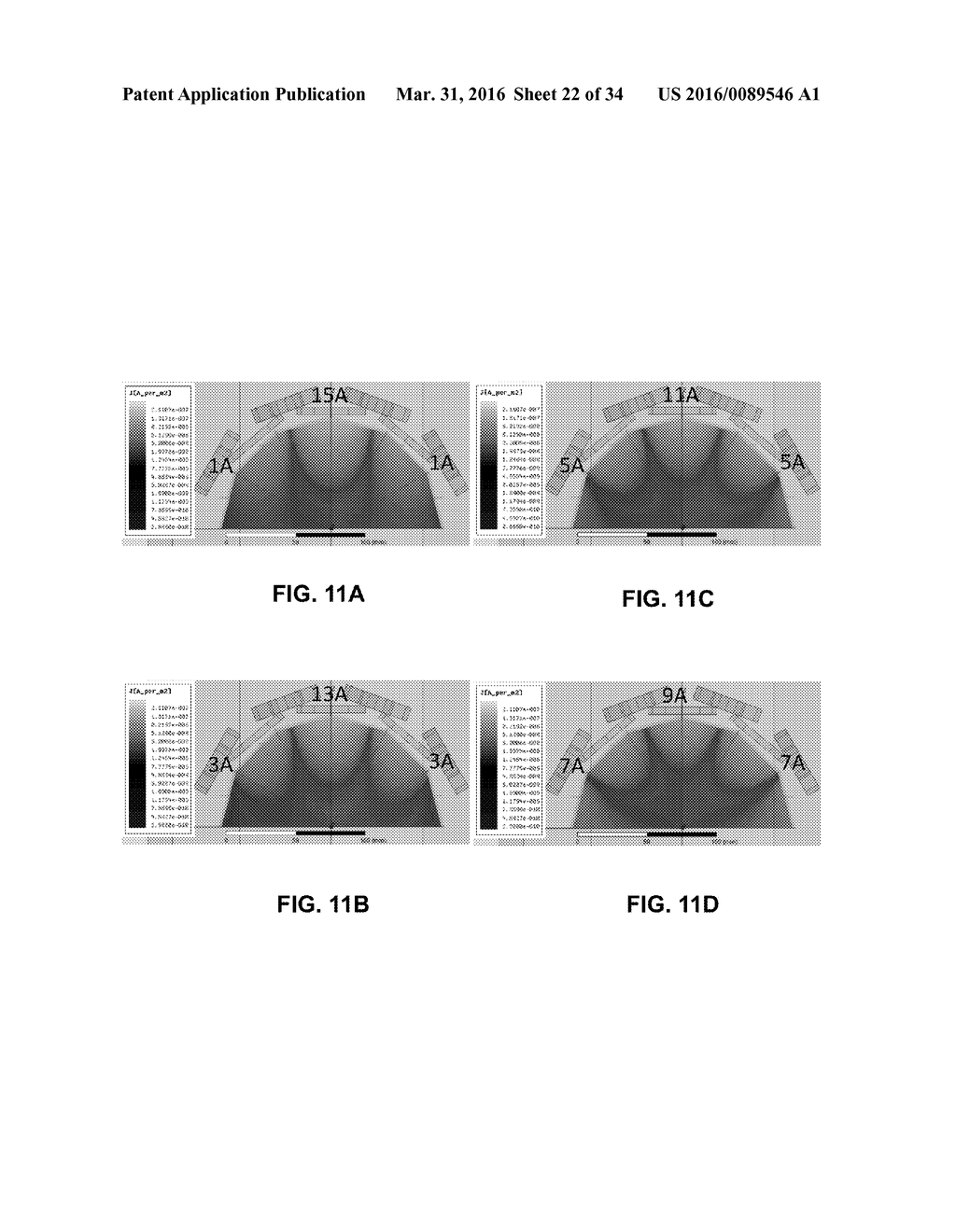 DEVICES AND METHODS FOR MAGNETIC STIMULATION FOR THE TREATMENT OF     NEUROLOGICAL DISORDERS - diagram, schematic, and image 23