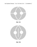 DEVICES AND METHODS FOR MAGNETIC STIMULATION FOR THE TREATMENT OF     NEUROLOGICAL DISORDERS diagram and image