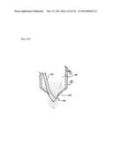 Apparatus for Receiving Heterogeneous Materials diagram and image