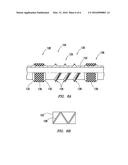 Expandable Liner Hanger with High Axial Load Capacity diagram and image