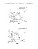 DIFFUSER CASE STRUT FOR A TURBINE ENGINE diagram and image