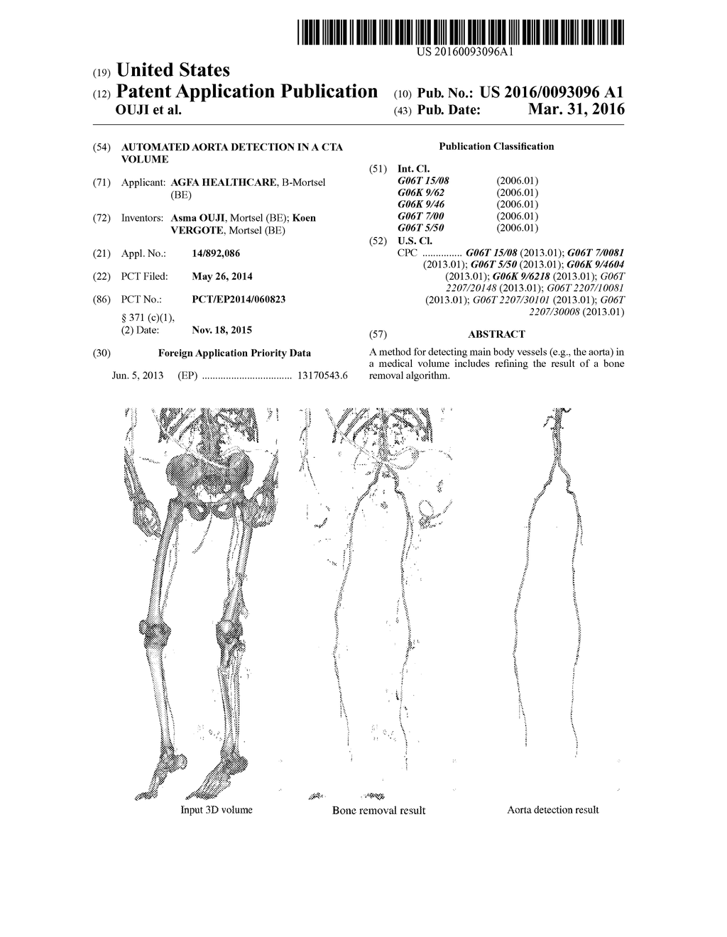 AUTOMATED AORTA DETECTION IN A CTA VOLUME - diagram, schematic, and image 01