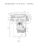 ORGAN TRANSPORT SYSTEM WITH ACTIVE TRACKING diagram and image