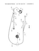 LASER VIDEO ENDOSCOPE diagram and image