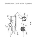 LASER VIDEO ENDOSCOPE diagram and image