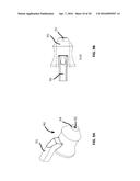 LASER VIDEO ENDOSCOPE diagram and image