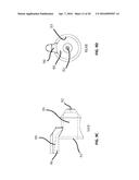 LASER VIDEO ENDOSCOPE diagram and image