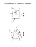 LASER VIDEO ENDOSCOPE diagram and image