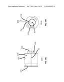 LASER VIDEO ENDOSCOPE diagram and image