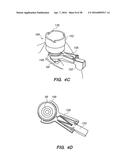 PATIENT INTERFACE FOR OPHTHALMOLOGIC DIAGNOSTIC AND INTERVENTIONAL     PROCEDURES diagram and image