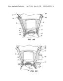 PATIENT INTERFACE FOR OPHTHALMOLOGIC DIAGNOSTIC AND INTERVENTIONAL     PROCEDURES diagram and image