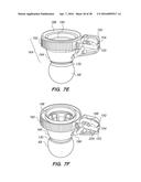 PATIENT INTERFACE FOR OPHTHALMOLOGIC DIAGNOSTIC AND INTERVENTIONAL     PROCEDURES diagram and image