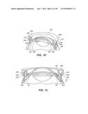 PATIENT INTERFACE FOR OPHTHALMOLOGIC DIAGNOSTIC AND INTERVENTIONAL     PROCEDURES diagram and image