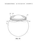 PATIENT INTERFACE FOR OPHTHALMOLOGIC DIAGNOSTIC AND INTERVENTIONAL     PROCEDURES diagram and image