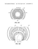 PATIENT INTERFACE FOR OPHTHALMOLOGIC DIAGNOSTIC AND INTERVENTIONAL     PROCEDURES diagram and image