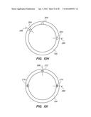 PATIENT INTERFACE FOR OPHTHALMOLOGIC DIAGNOSTIC AND INTERVENTIONAL     PROCEDURES diagram and image