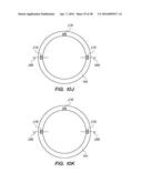 PATIENT INTERFACE FOR OPHTHALMOLOGIC DIAGNOSTIC AND INTERVENTIONAL     PROCEDURES diagram and image