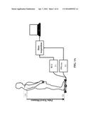 SYSTEMS AND METHODS FOR MONITORING THE CIRCULATORY SYSTEM diagram and image