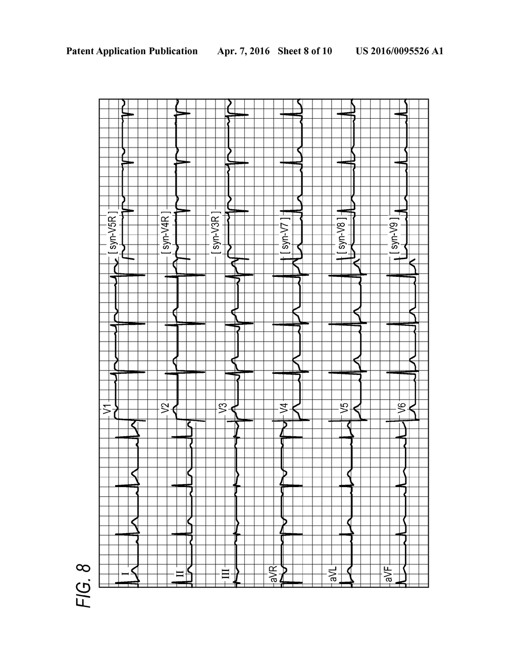 ELECTROCARDIOGRAM DISPLAY DEVICE - diagram, schematic, and image 09