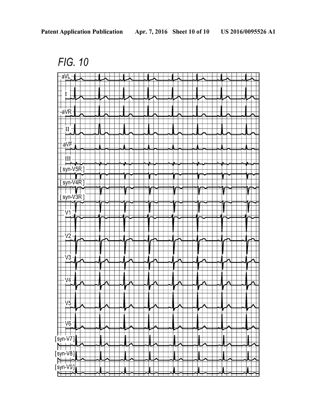 ELECTROCARDIOGRAM DISPLAY DEVICE - diagram, schematic, and image 11