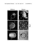 NON-INVASIVE RADIOFREQUENCY COIL FOR MAGNETIC RESONANCE IMAGING diagram and image