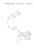 Infrasonic Stethoscope for Monitoring Physiological Processes diagram and image