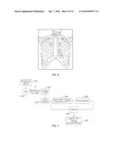 Infrasonic Stethoscope for Monitoring Physiological Processes diagram and image