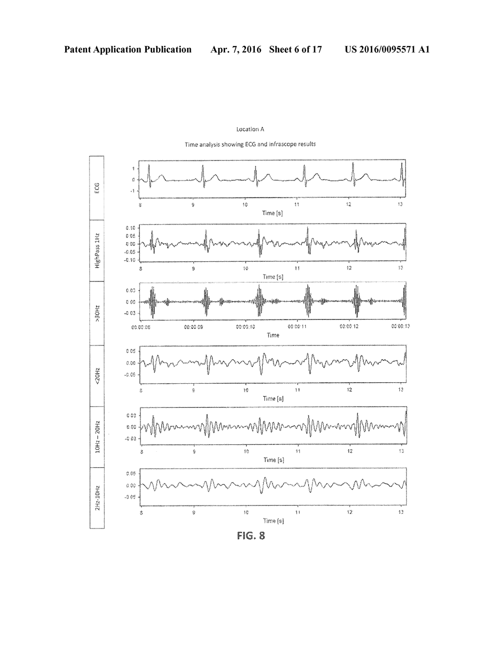 Infrasonic Stethoscope for Monitoring Physiological Processes - diagram, schematic, and image 07