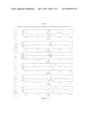 Infrasonic Stethoscope for Monitoring Physiological Processes diagram and image