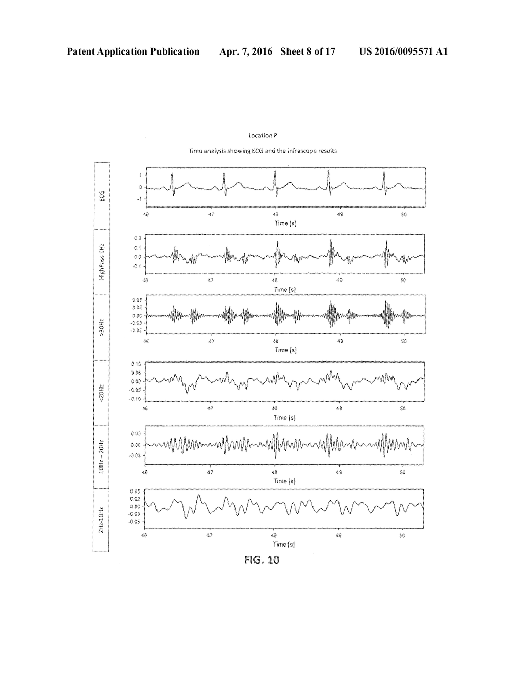 Infrasonic Stethoscope for Monitoring Physiological Processes - diagram, schematic, and image 09