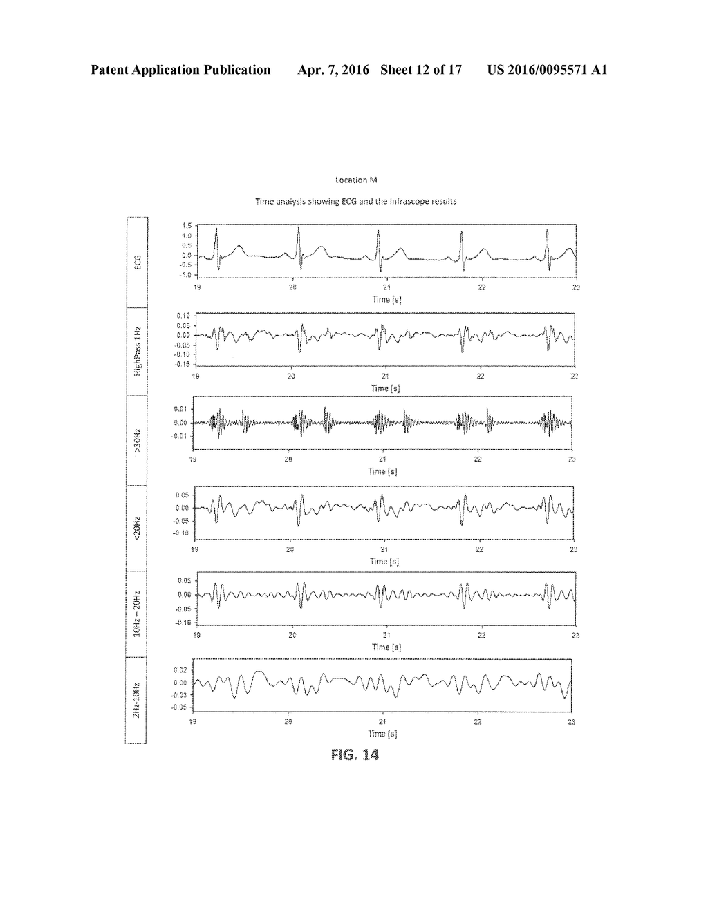 Infrasonic Stethoscope for Monitoring Physiological Processes - diagram, schematic, and image 13