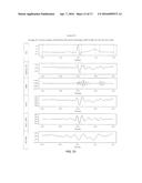 Infrasonic Stethoscope for Monitoring Physiological Processes diagram and image