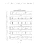 Infrasonic Stethoscope for Monitoring Physiological Processes diagram and image